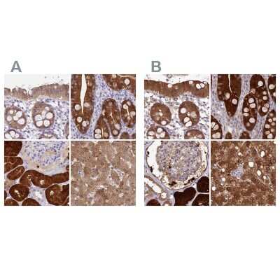 Immunohistochemistry-Paraffin: PBLD Antibody [NBP1-83683]