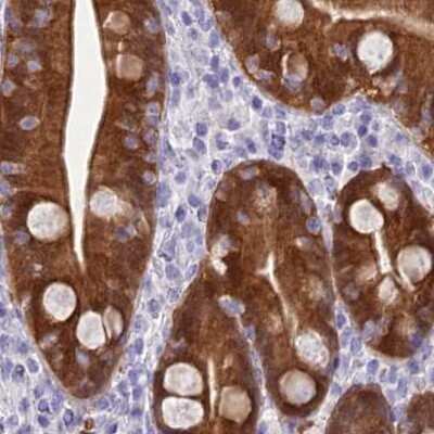 Immunohistochemistry-Paraffin: PBLD Antibody [NBP1-83683]