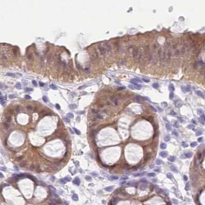 Immunohistochemistry-Paraffin: PBLD Antibody [NBP1-83683]