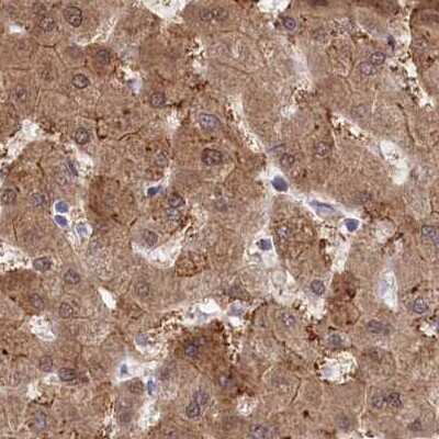 Immunohistochemistry-Paraffin: PBLD Antibody [NBP1-83683]