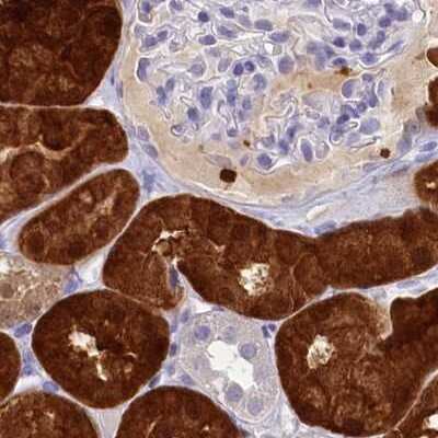 Immunohistochemistry-Paraffin: PBLD Antibody [NBP1-83683]