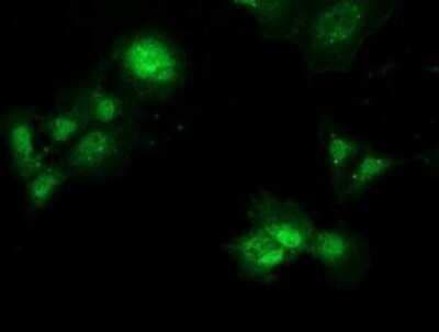 Immunocytochemistry/ Immunofluorescence: PBLD Antibody (OTI7G5) - Azide and BSA Free [NBP2-73262]