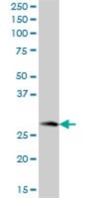 Western Blot: PBLD Antibody [H00064081-B01P]