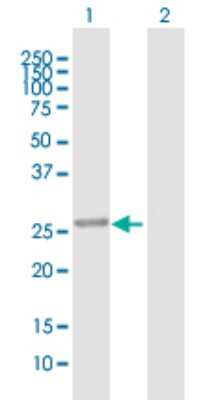 Western Blot: PBLD Antibody [H00064081-B01P]
