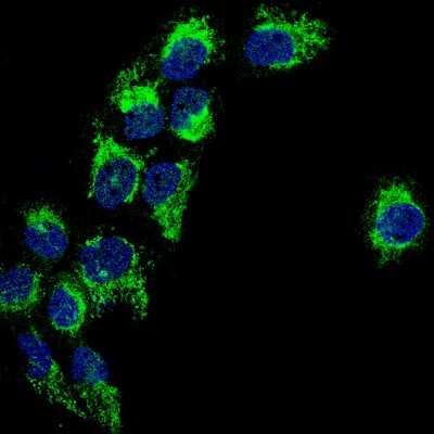 Immunocytochemistry/ Immunofluorescence: PBR Antibody (CL13358) [NBP3-18567]