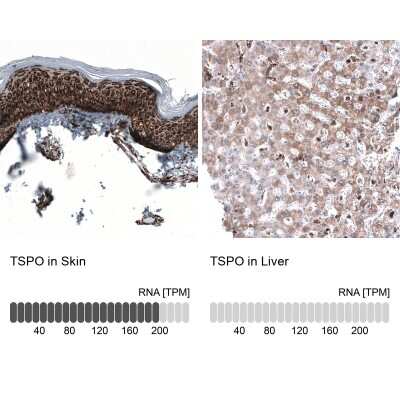 Immunohistochemistry-Paraffin: PBR Antibody (CL13358) [NBP3-18567]