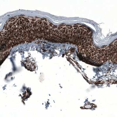 Immunohistochemistry-Paraffin: PBR Antibody (CL13358) [NBP3-18567]