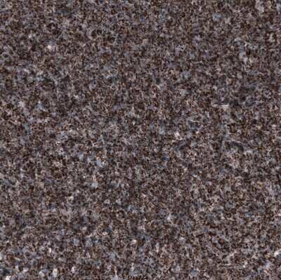 Immunohistochemistry-Paraffin: PBR Antibody (CL13358) [NBP3-18567]