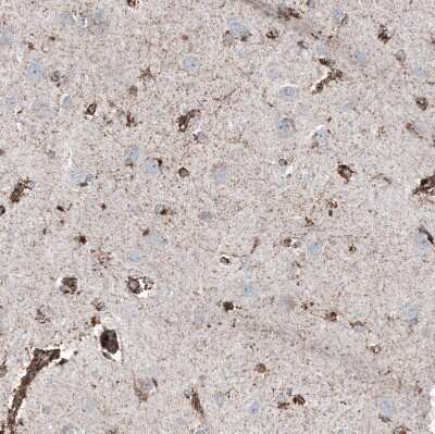 Immunohistochemistry-Paraffin: PBR Antibody (CL13358) [NBP3-18567]