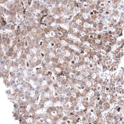 Immunohistochemistry-Paraffin: PBR Antibody (CL13358) [NBP3-18567]