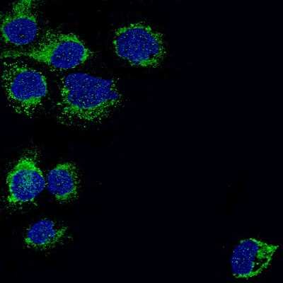 Immunocytochemistry/ Immunofluorescence: PBR Antibody (CL13359) [NBP3-18560]