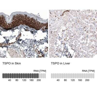 Immunohistochemistry-Paraffin: PBR Antibody (CL13359) [NBP3-18560]