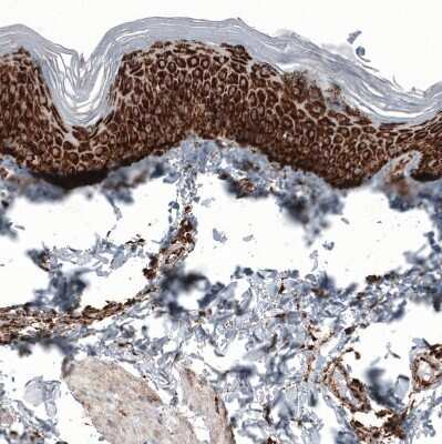 Immunohistochemistry-Paraffin: PBR Antibody (CL13359) [NBP3-18560]