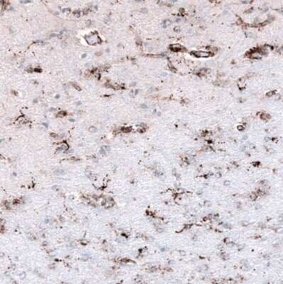 Immunohistochemistry-Paraffin: PBR Antibody (CL13359) [NBP3-18560]