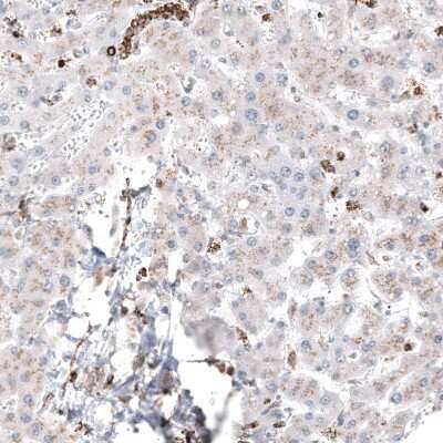 Immunohistochemistry-Paraffin: PBR Antibody (CL13359) [NBP3-18560]