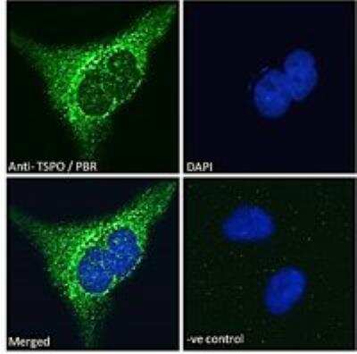 Immunocytochemistry/ Immunofluorescence: PBR Antibody [NB100-41398]