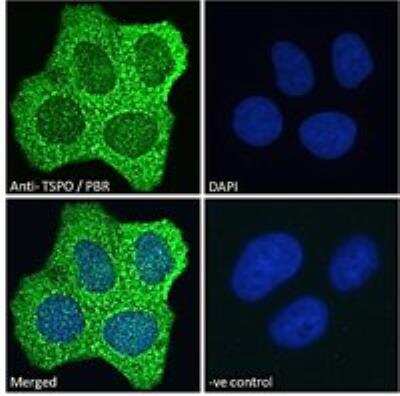 Immunocytochemistry/ Immunofluorescence: PBR Antibody [NB100-41398]