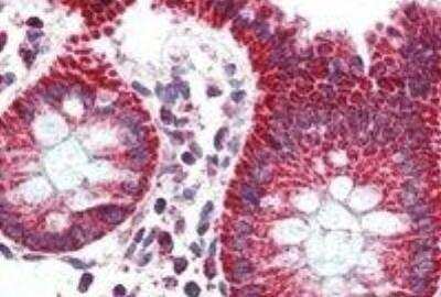 Immunohistochemistry-Paraffin: PBR Antibody [NB100-41398]