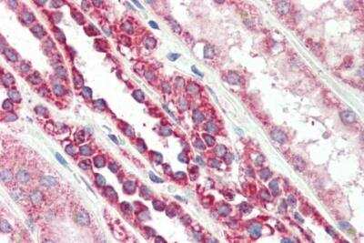 Immunohistochemistry-Paraffin: PBR Antibody [NB100-41398]