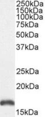 Western Blot: PBR Antibody [NBP1-51934]