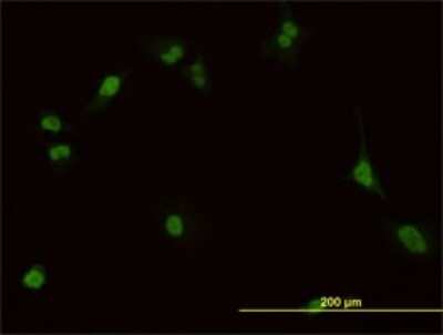 Immunocytochemistry/ Immunofluorescence: PBX1 Antibody (4A2) [H00005087-M01]