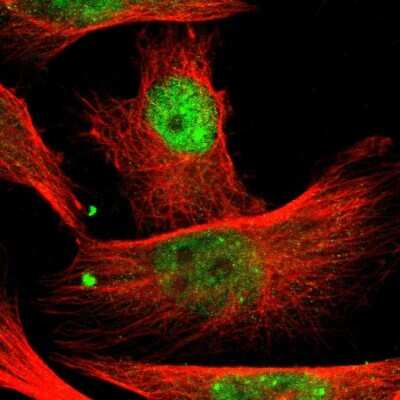 Immunocytochemistry/ Immunofluorescence: PBX1 Antibody [NBP1-86151]