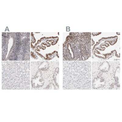 Immunohistochemistry-Paraffin: PBX1 Antibody [NBP1-86151]