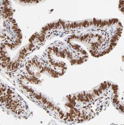 Immunohistochemistry-Paraffin: PBX1 Antibody [NBP1-86151]