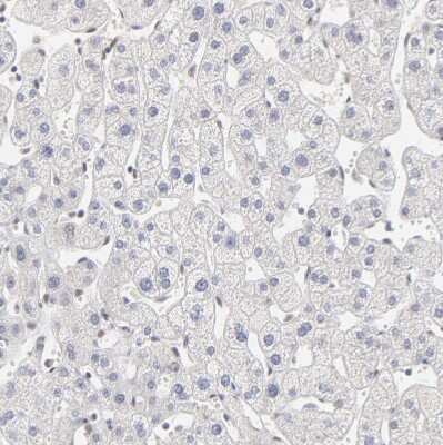 Immunohistochemistry-Paraffin: PBX1 Antibody [NBP1-86151]