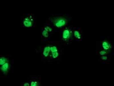 Immunocytochemistry/ Immunofluorescence: PBX1 Antibody (OTI1C11) - Azide and BSA Free [NBP2-73265]