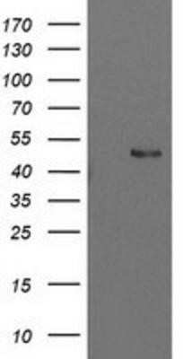 Western Blot: PBX1 Antibody (OTI1C11)Azide and BSA Free [NBP2-73265]