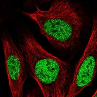Immunocytochemistry/ Immunofluorescence: PBX2 Antibody [NBP2-31853]