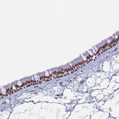Immunohistochemistry-Paraffin: PBX2 Antibody [NBP2-31853]