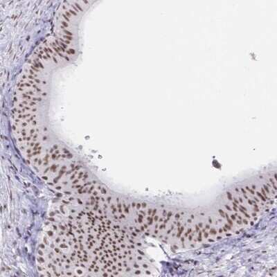 Immunohistochemistry-Paraffin: PBX2 Antibody [NBP2-31853]