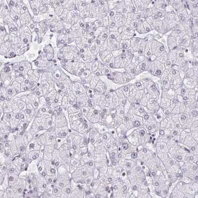 Immunohistochemistry-Paraffin: PBX2 Antibody [NBP2-31853]