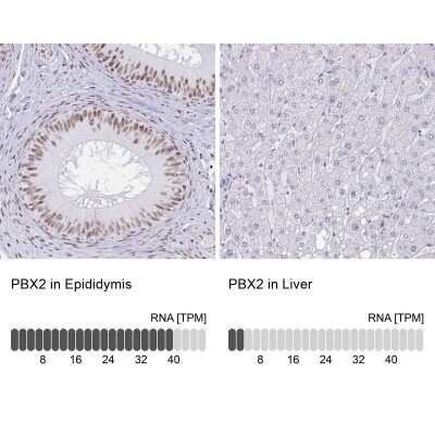 Immunohistochemistry-Paraffin: PBX2 Antibody [NBP2-31853]