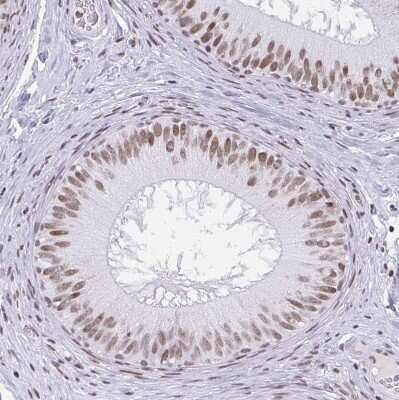 Immunohistochemistry-Paraffin: PBX2 Antibody [NBP2-31853]