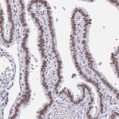 Immunohistochemistry-Paraffin: PBX2 Antibody [NBP2-31853]