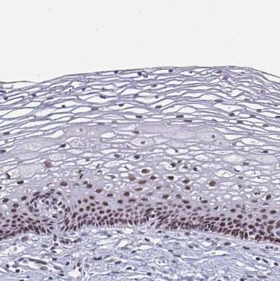 Immunohistochemistry-Paraffin: PBX2 Antibody [NBP2-31853]