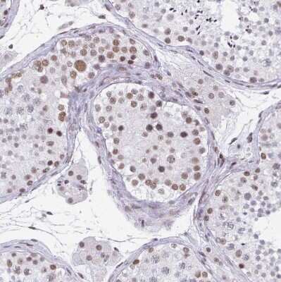 Immunohistochemistry-Paraffin: PBX2 Antibody [NBP2-31853]