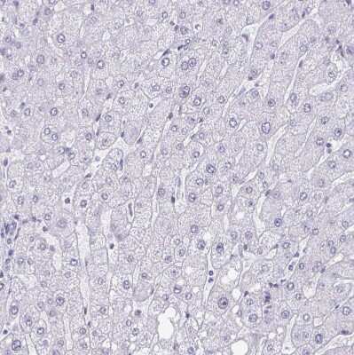 Immunohistochemistry-Paraffin: PBX2 Antibody [NBP2-31853]