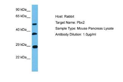 Western Blot: PBX2 Antibody [NBP2-85444]