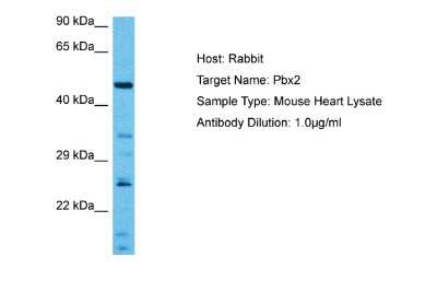 Western Blot: PBX2 Antibody [NBP2-85445]
