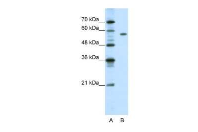 Western Blot: PBX2 Antibody [NBP2-85446]