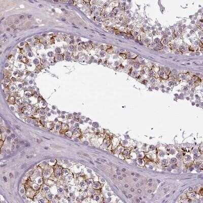 Immunohistochemistry-Paraffin: PBX4 Antibody [NBP2-13734]