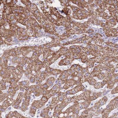 Immunohistochemistry-Paraffin: Proprotein Convertase 1/PCSK1 Antibody [NBP2-13741]