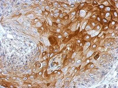 Immunohistochemistry-Paraffin: Proprotein Convertase 1/PCSK1 Antibody [NBP2-19714]