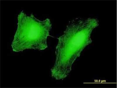 Immunocytochemistry/ Immunofluorescence: PCAF Antibody (2B4) [H00008850-M01]