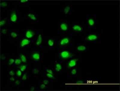 Immunocytochemistry/ Immunofluorescence: PCAF Antibody (5E11) [H00008850-M04]