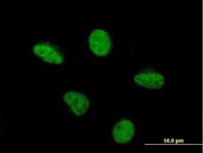 Immunocytochemistry/ Immunofluorescence: PCAF Antibody (5E5) [H00008850-M06]
